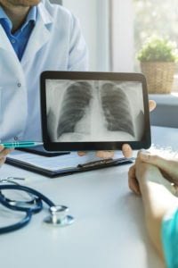 Close-up of doctor showing chest x-ray to patient.