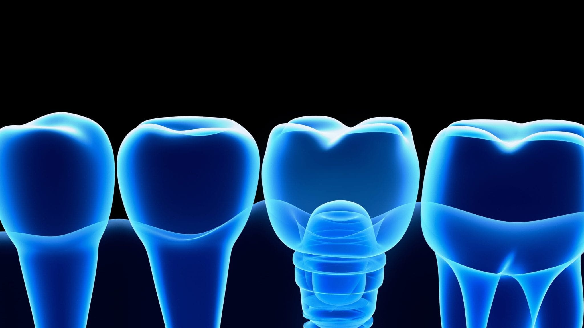 dental-malpractice teeth